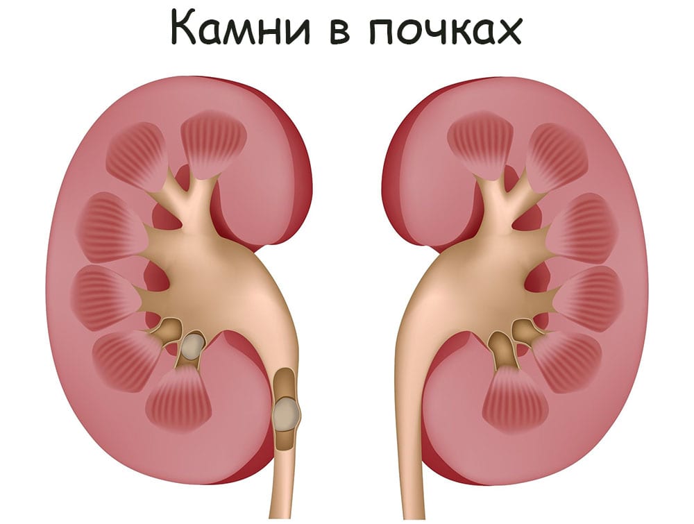 Кракен купить порошок